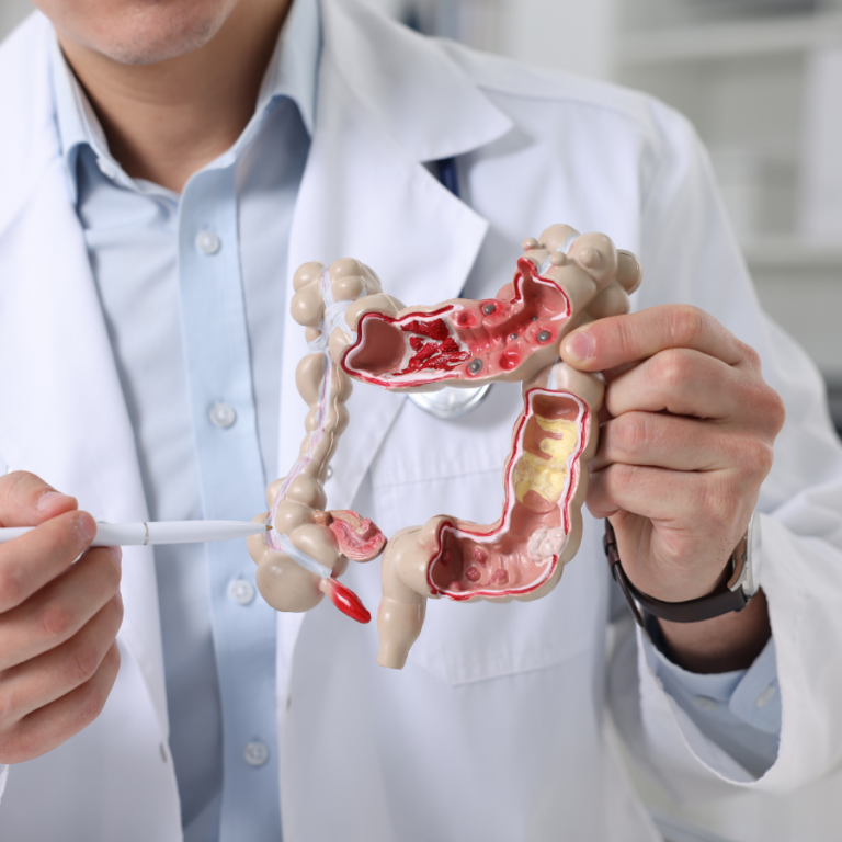 Doctor holding a model of human intestines.